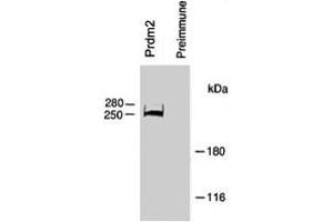 Rat B50 brain tumor cell extracts were immunoprecipitated with Prdm2 polyclonal antibody  or preimmune. (PRDM2 Antikörper  (AA 245-573))
