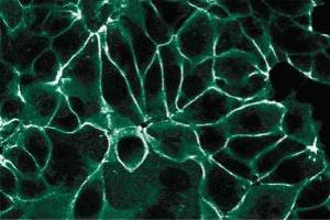 Immunofluorescence staining of MCF7 cells. (JUP Antikörper  (AA 553-738))
