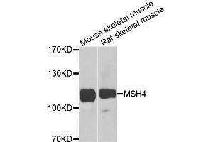 Western blot analysis of extracts of various cells, using MSH4 antibody.