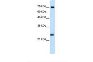 Image no. 2 for anti-SERTA Domain Containing 1 (SERTAD1) (N-Term) antibody (ABIN324352) (SERTAD1 Antikörper  (N-Term))
