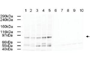 Western blot using AP2A1 polyclonal antibody  shows detection of a band just below 100 KDa correspond-ing to Human AP2A1 in a various preparations. (alpha Adaptin Antikörper  (AA 3-14))