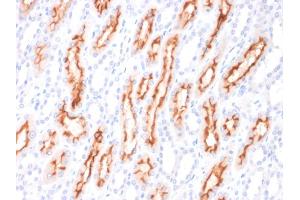 Immunohistochemistry (IHC) image for anti-Tumor Necrosis Factor (Ligand) Superfamily, Member 9 (TNFSF9) antibody (ABIN6940973)