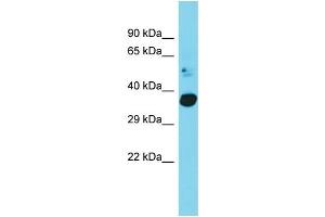 Host: Rabbit Target Name: C20orf72 Sample Type: Fetal Heart lysates Antibody Dilution: 1. (C20orf72 Antikörper  (C-Term))