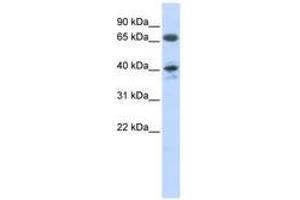 Image no. 1 for anti-Angiotensin II Receptor, Type 1 (AGTR1) (AA 37-86) antibody (ABIN6740751) (Angiotensin II Type-1 Receptor Antikörper  (AA 37-86))