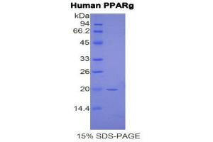 SDS-PAGE (SDS) image for Peroxisome Proliferator-Activated Receptor gamma (PPARG) (AA 349-488) protein (His tag) (ABIN1877737)