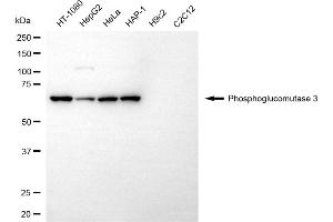 Western blotting analysis using phosphoglucomutase 3 antibody (ABIN7799806). (Phosphoglucomutase 3 Antikörper)
