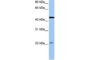 WB Suggested Anti-EWSR1 Antibody Titration:  0.