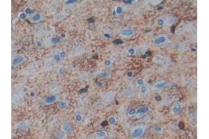 DAB staining on IHC-P; Samples: Rat Cerebrum Tissue