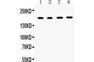 Anti- THBS1 Picoband antibody, Western blotting All lanes: Anti THBS1  at 0. (Thrombospondin 1 Antikörper  (N-Term))