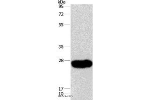 Western blot analysis of Human fetal muscle tissue, using CAV3 Polyclonal Antibody at dilution of 1:550 (Caveolin 3 Antikörper)