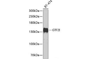 Western blot analysis of extracts of BT-474 cells using GTF2I Polyclonal Antibody at dilution of 1:500. (GTF2I Antikörper)