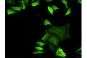 Immunofluorescence of monoclonal antibody to FLNA on HeLa cell. (Filamin A Antikörper  (AA 1-838))