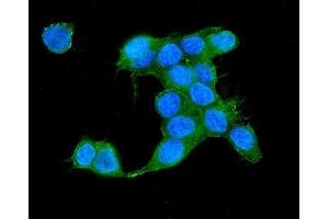 IF analysis of IQGAP2 using anti-IQGAP2 antibody (ABIN5692877). (IQGAP2 Antikörper  (AA 1329-1544))