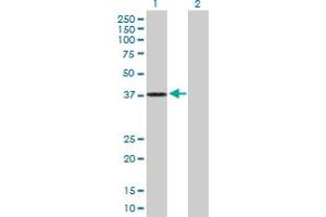 Western Blot analysis of DHRS7 expression in transfected 293T cell line by DHRS7 MaxPab polyclonal antibody. (DHRS7 Antikörper  (AA 1-339))