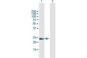 Western Blotting (WB) image for anti-Inverted Formin, FH2 and WH2 Domain Containing (INF2) (AA 1-234) antibody (ABIN528649)