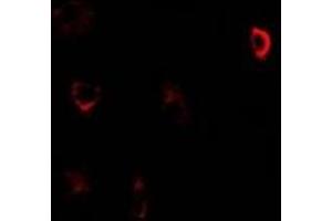 Immunofluorescent analysis of CBS staining in U2OS cells. (CBS Antikörper)