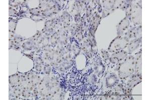 Image no. 2 for anti-Cell Division Cycle 25 Homolog C (S. Pombe) (CDC25C) (AA 21-130) antibody (ABIN598558) (CDC25C Antikörper  (AA 21-130))