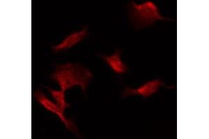 ABIN6274470 staining COLO205 by IF/ICC. (ORCTL-2/SLC22A18 Antikörper  (C-Term))