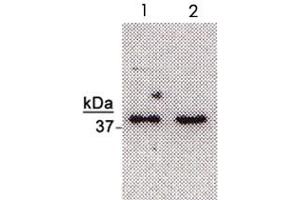 Western blot analysis of NTHL1 in HeLa (Lane2) and K-562 (Lane1) cell extracts with NTHL1 polyclonal antibody . (Nth Endonuclease III-Like 1 (NTHL1) Antikörper)