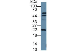 Detection of DTYMK in Human A549 cell lysate using Polyclonal Antibody to Deoxythymidylate Kinase (DTYMK) (DTYMK Antikörper  (AA 43-190))
