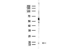 anti-NHP2 Ribonucleoprotein (NHP2) (Internal Region) antibody