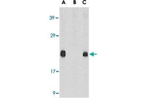 Western blot analysis of Diablo in mouse heart tissue lysate in the absence (A) or presence (B) of blocking peptide and in rat heart tissue lysate (C) with Diablo polyclonal antibody  at 1 ug /mL . (DIABLO Antikörper  (AA 222-237))