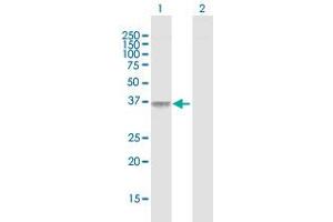 F11R anticorps  (AA 1-299)