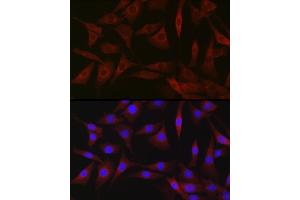 Immunofluorescence analysis of NIH-3T3 cells using BDKRB1 Rabbit pAb (ABIN7265910) at dilution of 1:250 (40x lens). (BDKRB1 Antikörper  (AA 1-100))