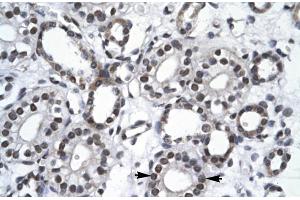 Rabbit Anti-RBM10 Antibody Catalog Number: ARP30103 Paraffin Embedded Tissue: Human Kidney Cellular Data: Epithelial cells of collecting tubule Antibody Concentration: 4. (RBM10 Antikörper  (N-Term))