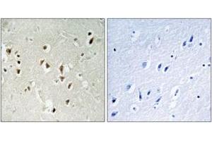 Immunohistochemistry analysis of paraffin-embedded human brain tissue, using GRF-1 (Ab-1105) Antibody. (GRLF1 Antikörper  (AA 1071-1120))