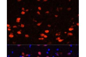 Immunofluorescence analysis of Rat brain using CALB2 Polyclonal Antibody at dilution of 1:100. (Calretinin Antikörper)