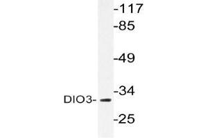 Western blot (WB) analysis of DIO3 antibody in extracts from HUVEC cells. (DIO3 Antikörper)