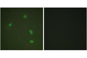 Immunofluorescence analysis of A549 cells, using Progesterone Receptor (Phospho-Ser400) Antibody. (Progesterone Receptor Antikörper  (pSer400))