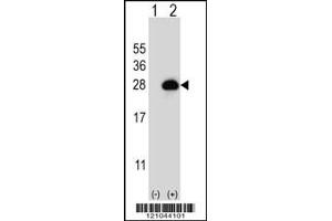 Western blot analysis of RAB3B using rabbit polyclonal RAB3B Antibody using 293 cell lysates (2 ug/lane) either nontransfected (Lane 1) or transiently transfected (Lane 2) with the RAB3B gene. (RAB3B Antikörper  (C-Term))