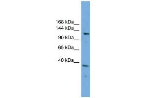 WB Suggested Anti-EIF4ENIF1  Antibody Titration: 0. (EIF4ENIF1 Antikörper  (N-Term))