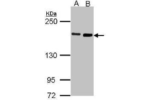 WB Image Sample (30 ug of whole cell lysate) A: H1299 B: Raji 7. (DIAPH1 Antikörper  (N-Term))
