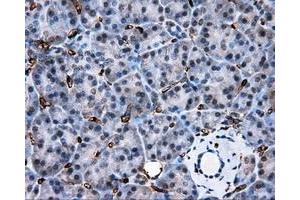 Immunohistochemical staining of paraffin-embedded liver tissue using anti-AKR1A1 mouse monoclonal antibody. (AKR1A1 Antikörper)