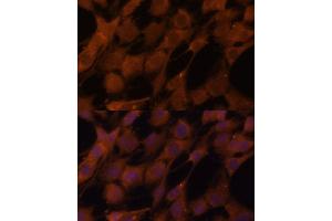 Immunofluorescence analysis of C6 cells using Legumain (Legumain (LGMN)) Polyclonal Antibody (ABIN6128201, ABIN6143172, ABIN6143173 and ABIN6214867) at dilution of 1:100 (40x lens). (LGMN Antikörper  (AA 18-323))