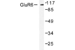Image no. 1 for anti-Glutamate Receptor, Ionotropic, Kainate 2 (GRIK2) antibody (ABIN265439) (GRIK2 Antikörper)