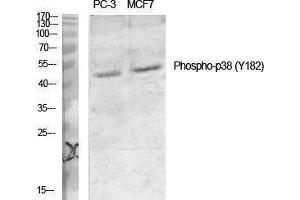 Western Blotting (WB) image for anti-Mitogen-Activated Protein Kinase 14 (MAPK14) (pTyr182) antibody (ABIN3182102) (MAPK14 Antikörper  (pTyr182))