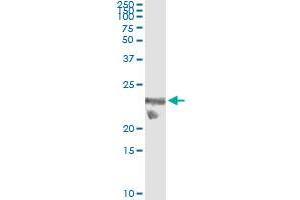 Immunoprecipitation (IP) image for anti-TSC22 Domain Family, Member 3 (TSC22D3) (AA 1-97) antibody (ABIN560657)