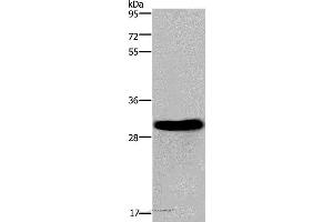 Western blot analysis of Mouse heart tissue, using FHL2 Polyclonal Antibody at dilution of 1:2400