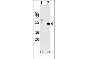 Image no. 1 for anti-TNF Receptor-Associated Factor 2 (TRAF2) (C-Term) antibody (ABIN360166) (TRAF2 Antikörper  (C-Term))