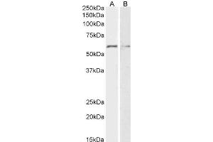 ABIN5539533 (2µg/ml) staining of HeLa (A) and K562 (B) lysates (35µg protein in RIPA buffer). (GPC1 Antikörper  (Internal Region))