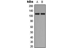 Western blot analysis of Topoisomerase 3 alpha expression in A549 (A), MCF7 (B) whole cell lysates.