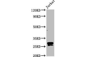 Western Blot Positive WB detected in Jurkat whole cell lysate All lanes CD99 antibody at 0. (Rekombinanter CD99 Antikörper)