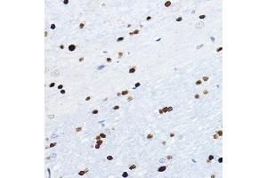 Immunohistochemistry of paraffin-embedded mouse brain using SOX10 Rabbit pAb (ABIN7270568) at dilution of 1:100 (40x lens). (SOX10 Antikörper  (AA 200-300))