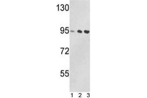 Western blot analysis of VCP antibody and 1) Jurkat, 2) 293, and 3) MDA-MB231 lysate. (VCP Antikörper  (AA 726-755))