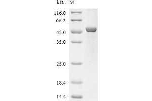(Tris-Glycine gel) Discontinuous SDS-PAGE (reduced) with 5 % enrichment gel and 15 % separation gel.