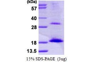 UBE2D3 Protein (AA 1-149) (His tag)